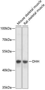 Polyclonal Rabbit anti-Human DHH / Desert Hedgehog Antibody (WB)