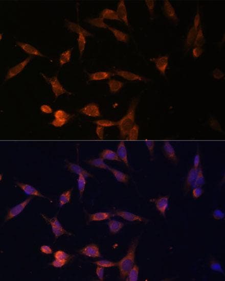 Polyclonal Rabbit anti-Human UMPS / OPRT Antibody (IF)