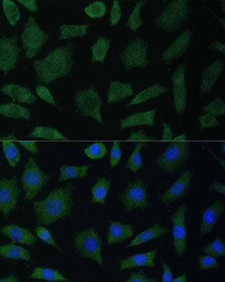 Polyclonal Rabbit anti-Human PTK2B / PYK2 Antibody (IF)