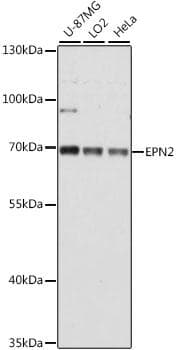 Polyclonal Rabbit anti-Human EPN2 Antibody (WB)