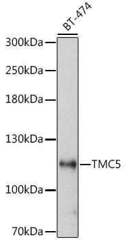 Polyclonal Rabbit anti-Human TMC5 Antibody (WB)