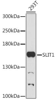 Polyclonal Rabbit anti-Human SLIT1 Antibody (WB)