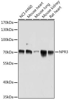 Polyclonal Rabbit anti-Human NPR3 Antibody (WB)