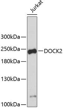 Polyclonal Rabbit anti-Human DOCK2 Antibody (WB)
