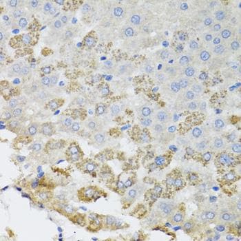 Polyclonal Rabbit anti-Human TROVE2 Antibody (IHC)