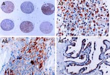 BIRC5 / Survivin Antibody