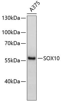 Polyclonal Rabbit anti-Human SOX10 Antibody (WB)