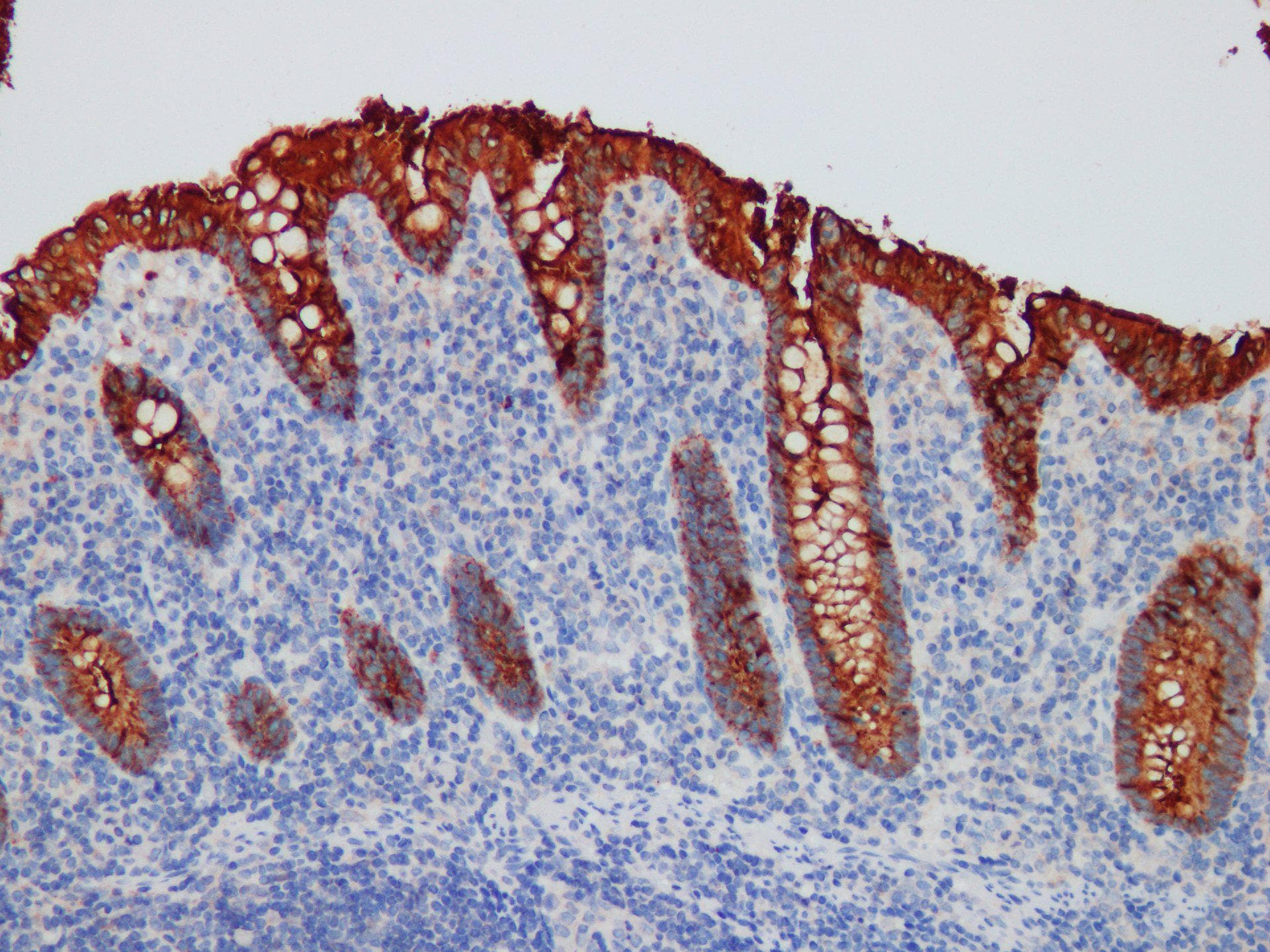 Monoclonal Mouse anti-Human CEACAM5 / CD66e Antibody (IHC)