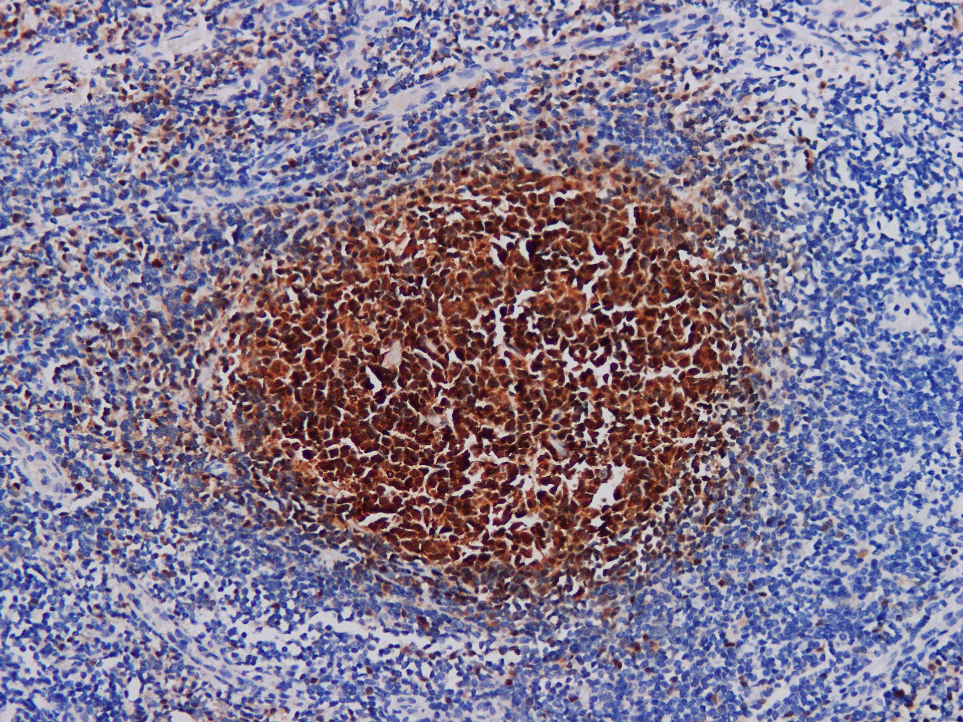 Monoclonal Mouse anti-Human POU2AF1 / BOB1 Antibody (IHC)
