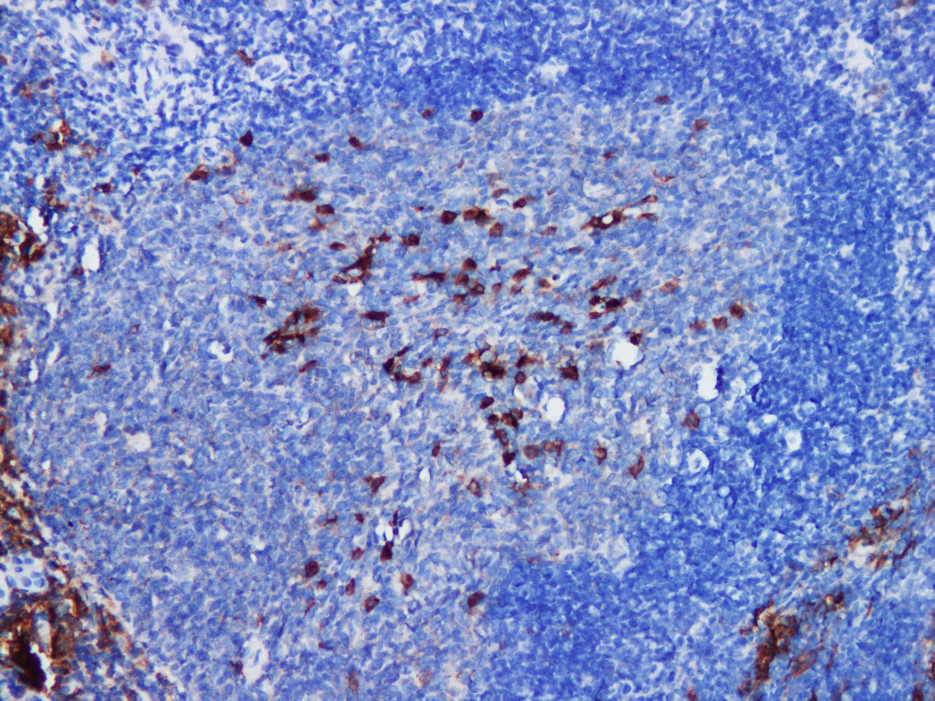 Monoclonal Rabbit CD38 Antibody (IHC)