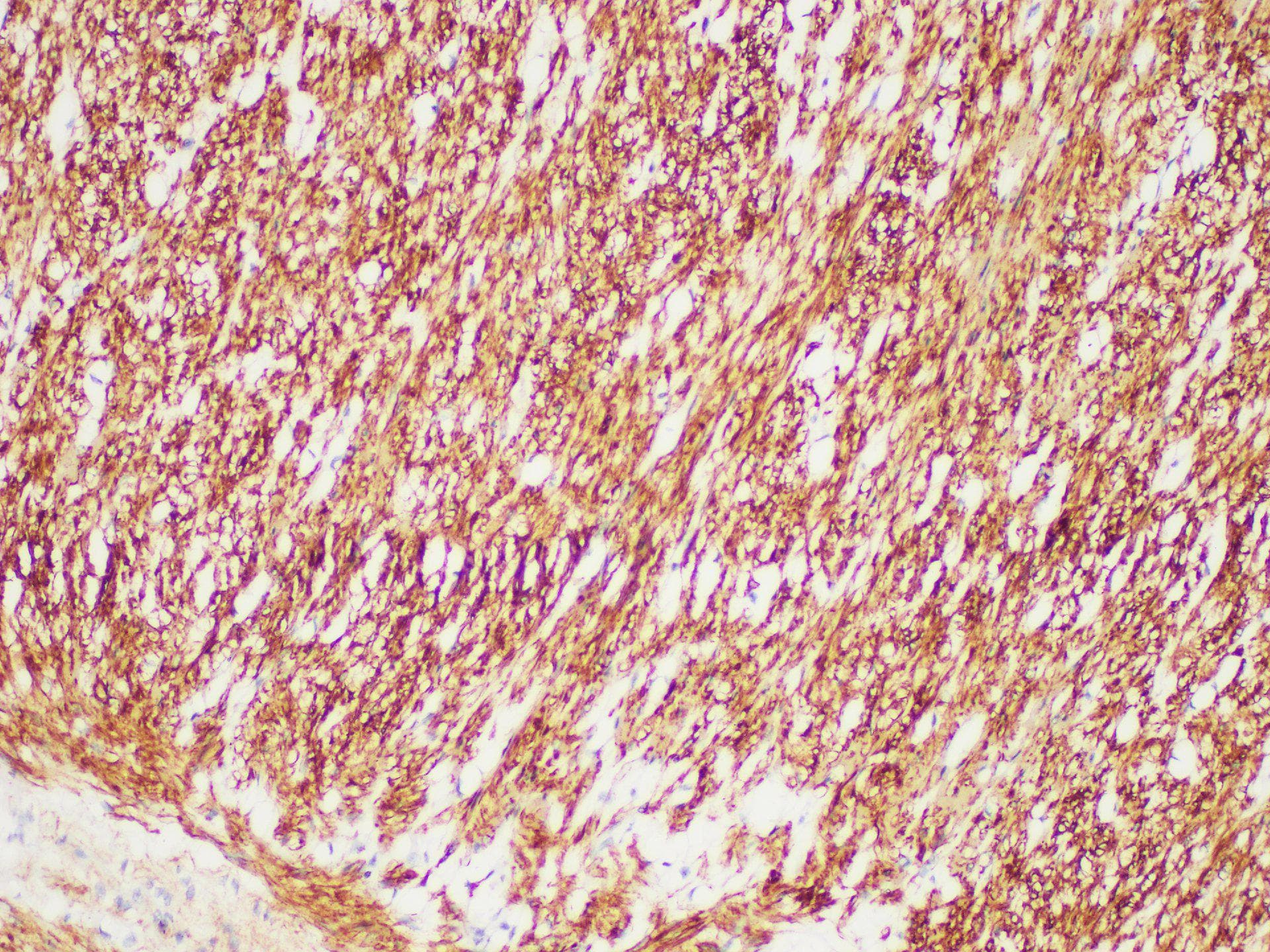 Monoclonal Mouse anti-Human DES / Desmin Antibody (IHC)