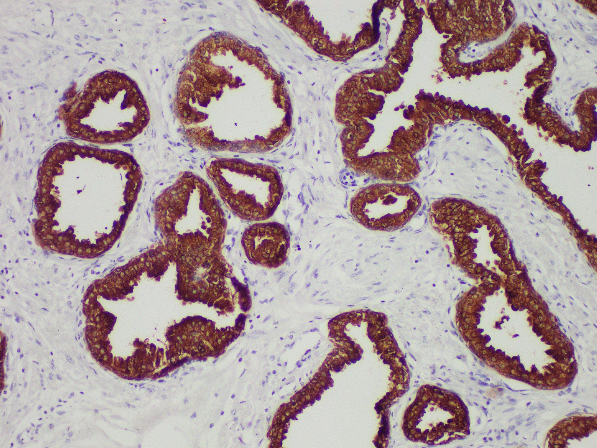 Monoclonal Mouse anti-Human KLK3 / PSA Antibody (IHC)
