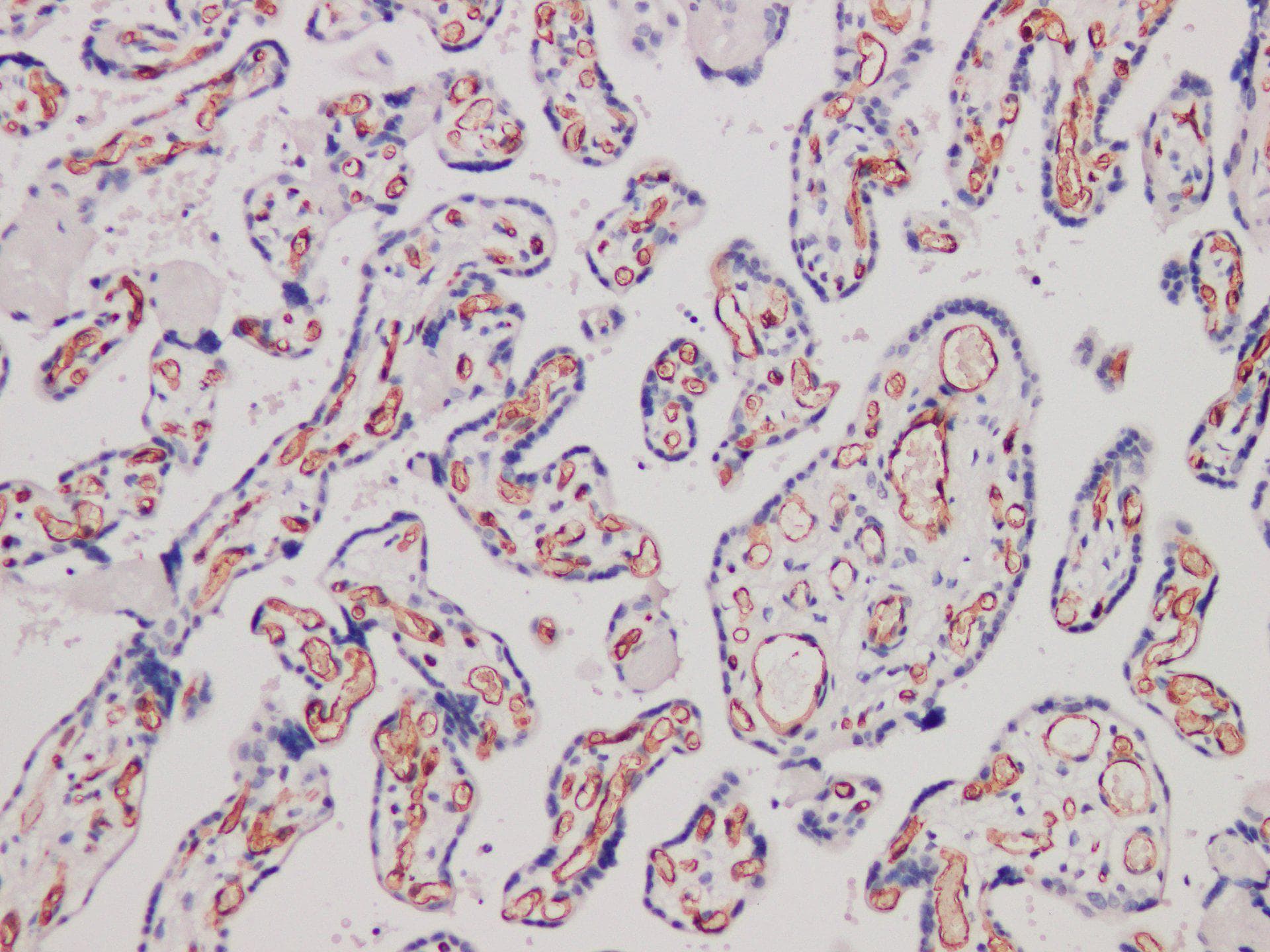 Monoclonal Rabbit anti-Human CD34 Antibody (IHC)