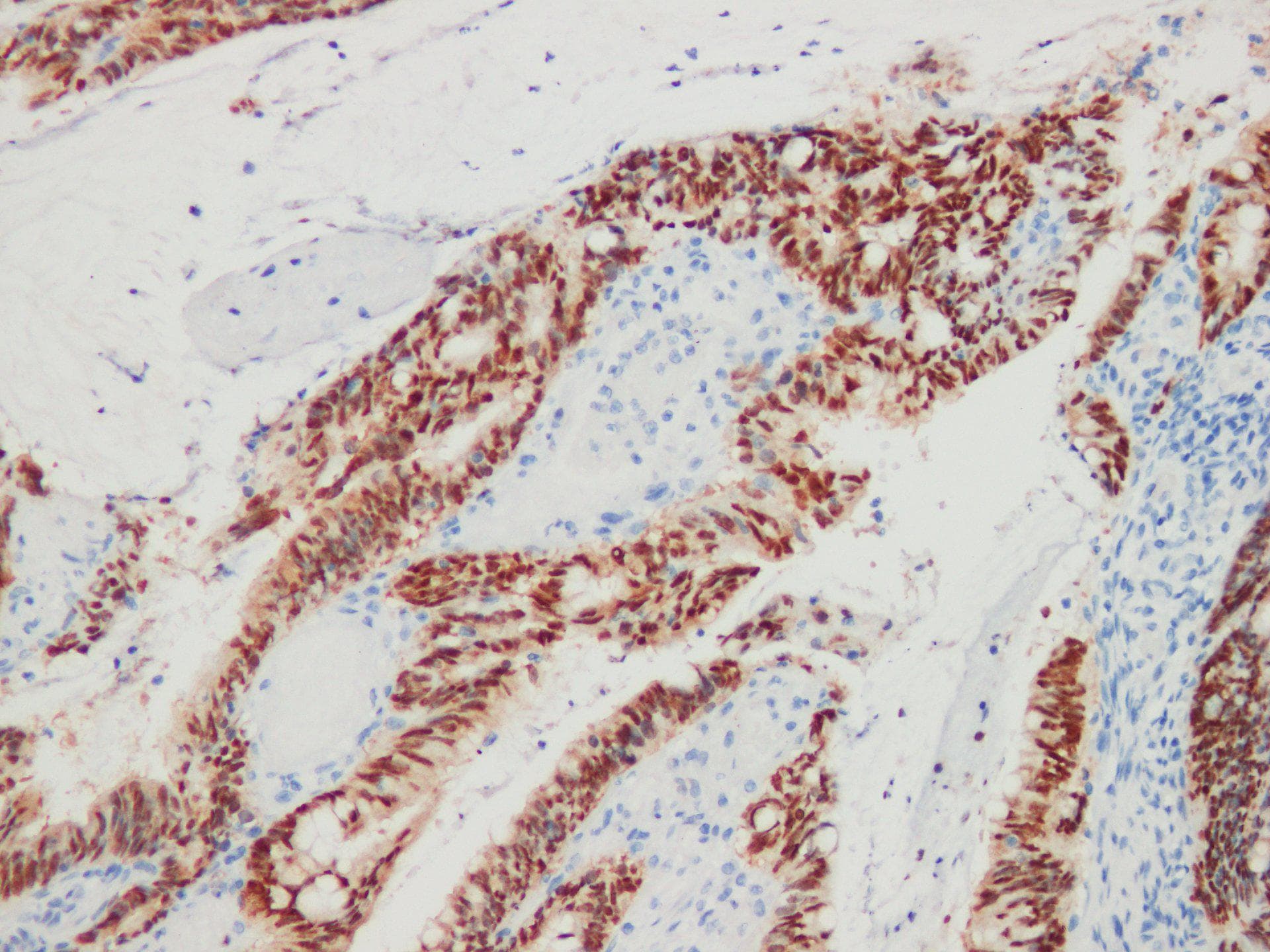 Monoclonal Mouse anti-Human CDX2 Antibody (IHC)