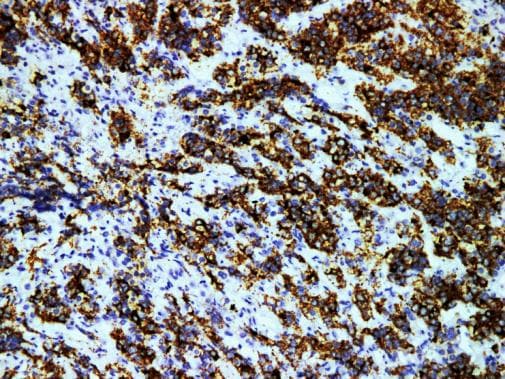 Monoclonal Mouse anti-Human PRL / Prolactin Antibody (IHC)