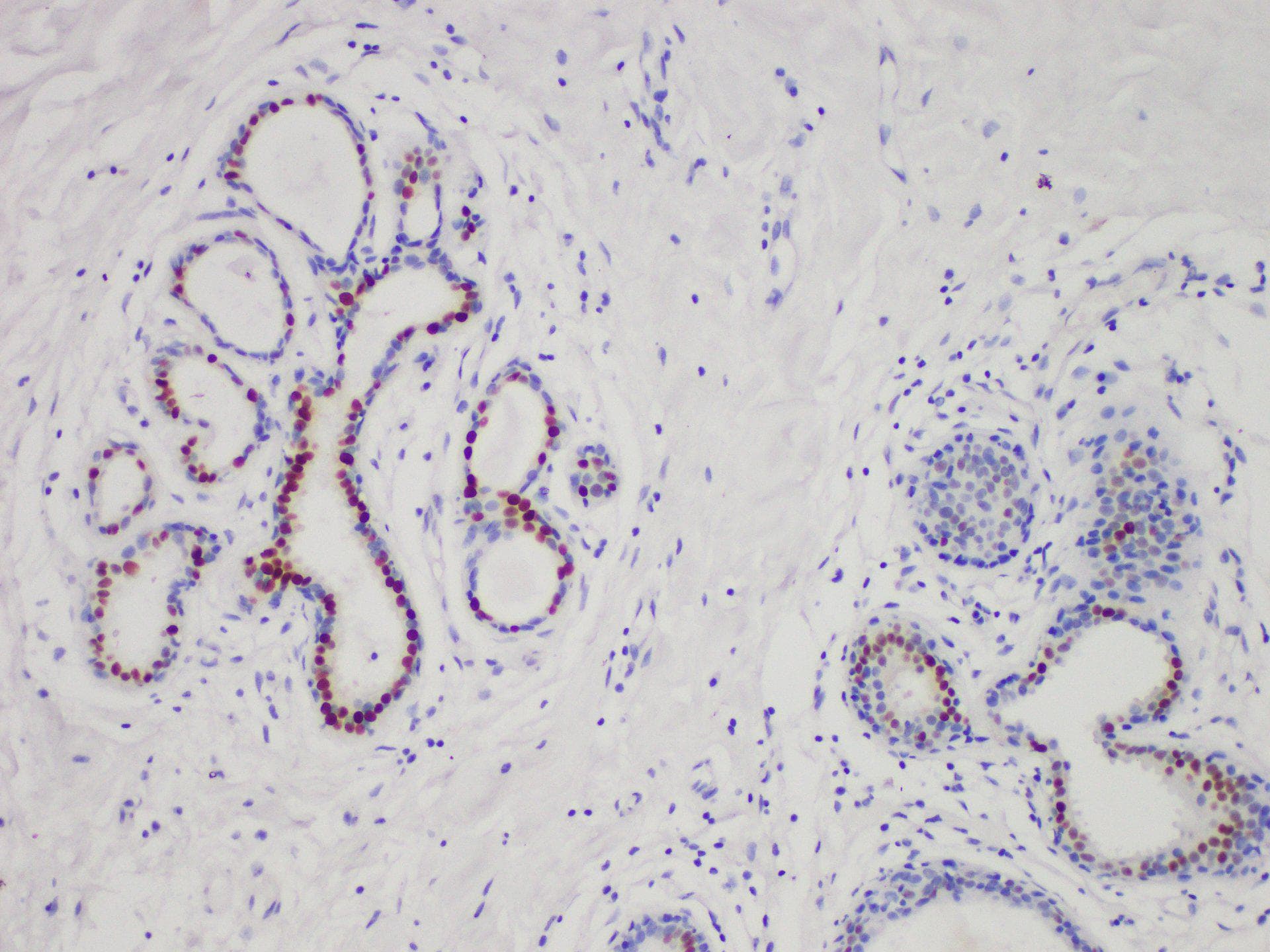 ER Alpha / Estrogen Receptor Antibody