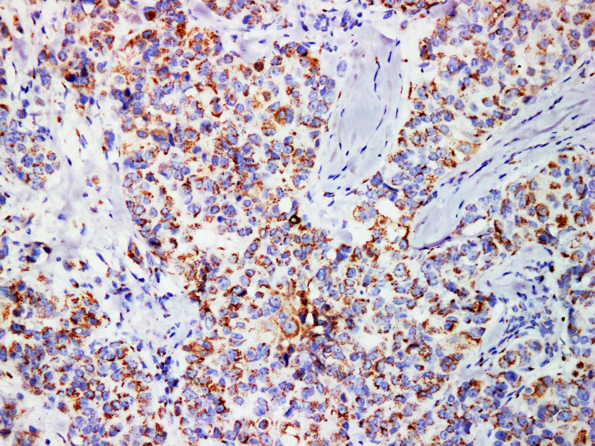 Monoclonal Mouse anti-Human SCGB2A2 / Mammaglobin A Antibody (IHC)