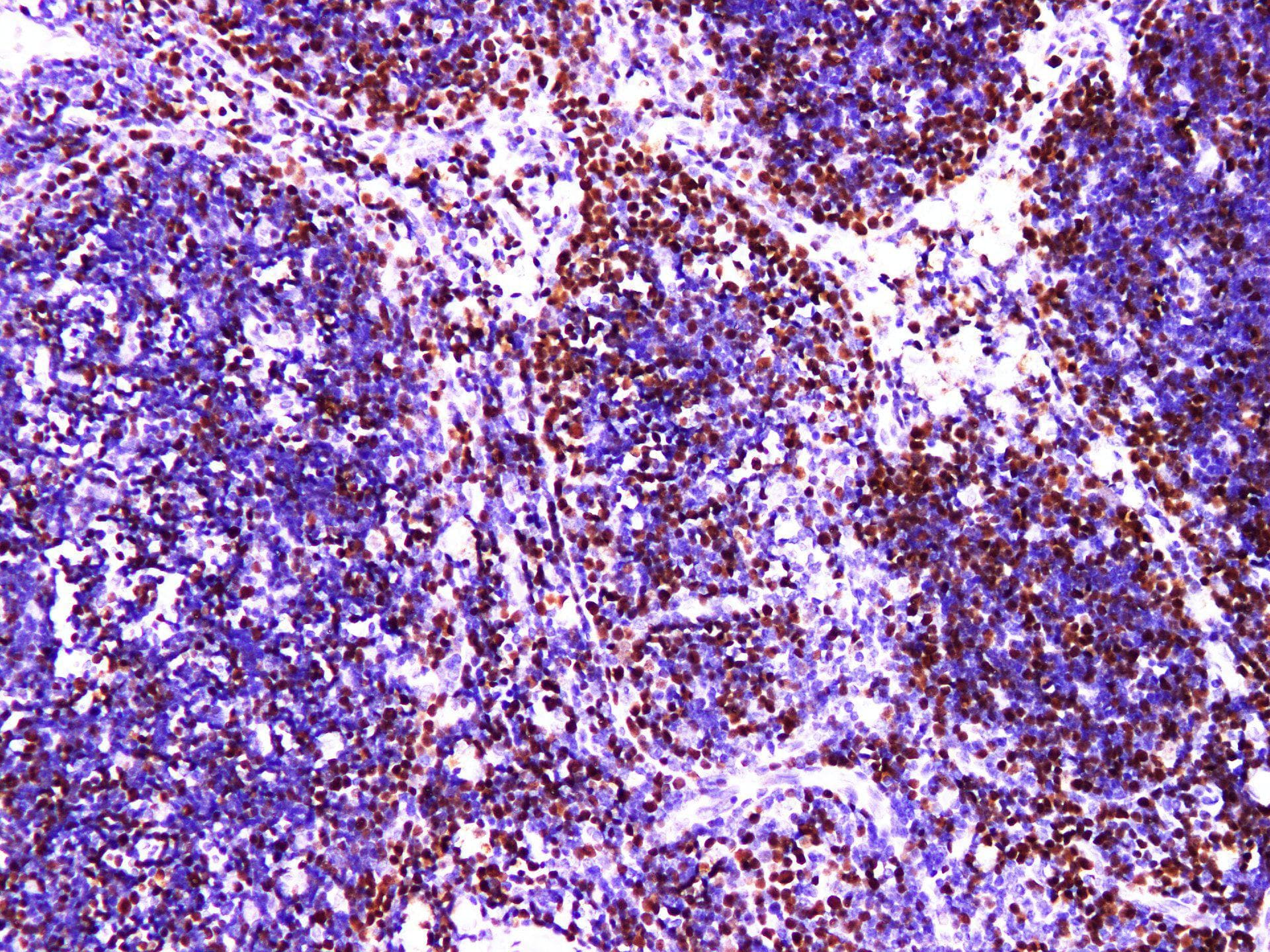 Monoclonal Mouse anti-Human MCM2 Antibody (IHC)