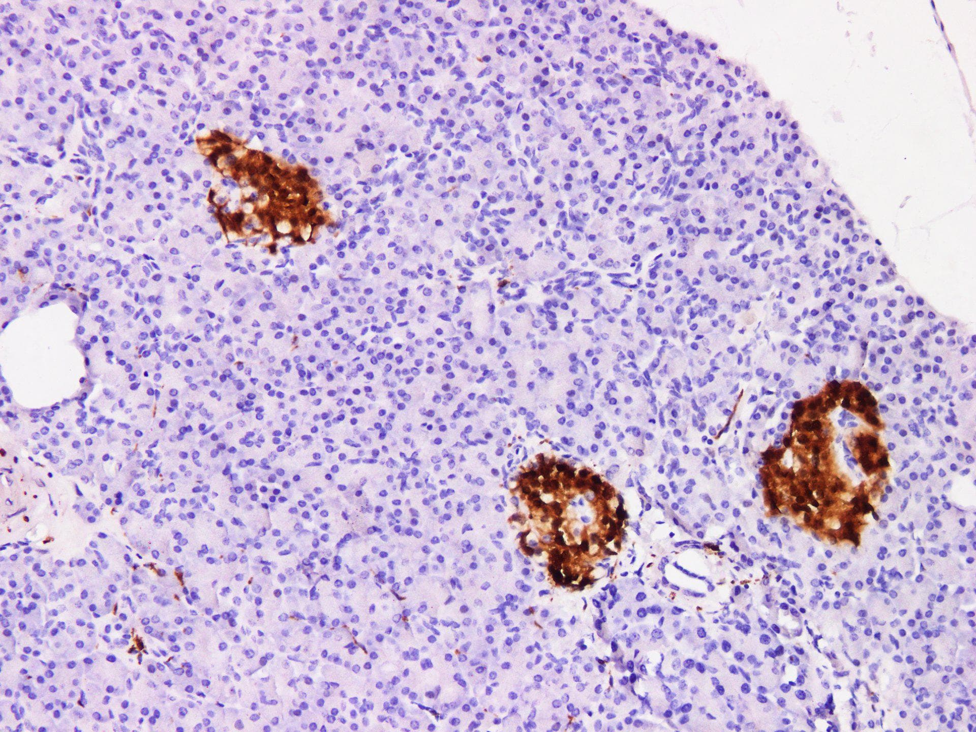 UCHL1 / PGP9.5 Antibody