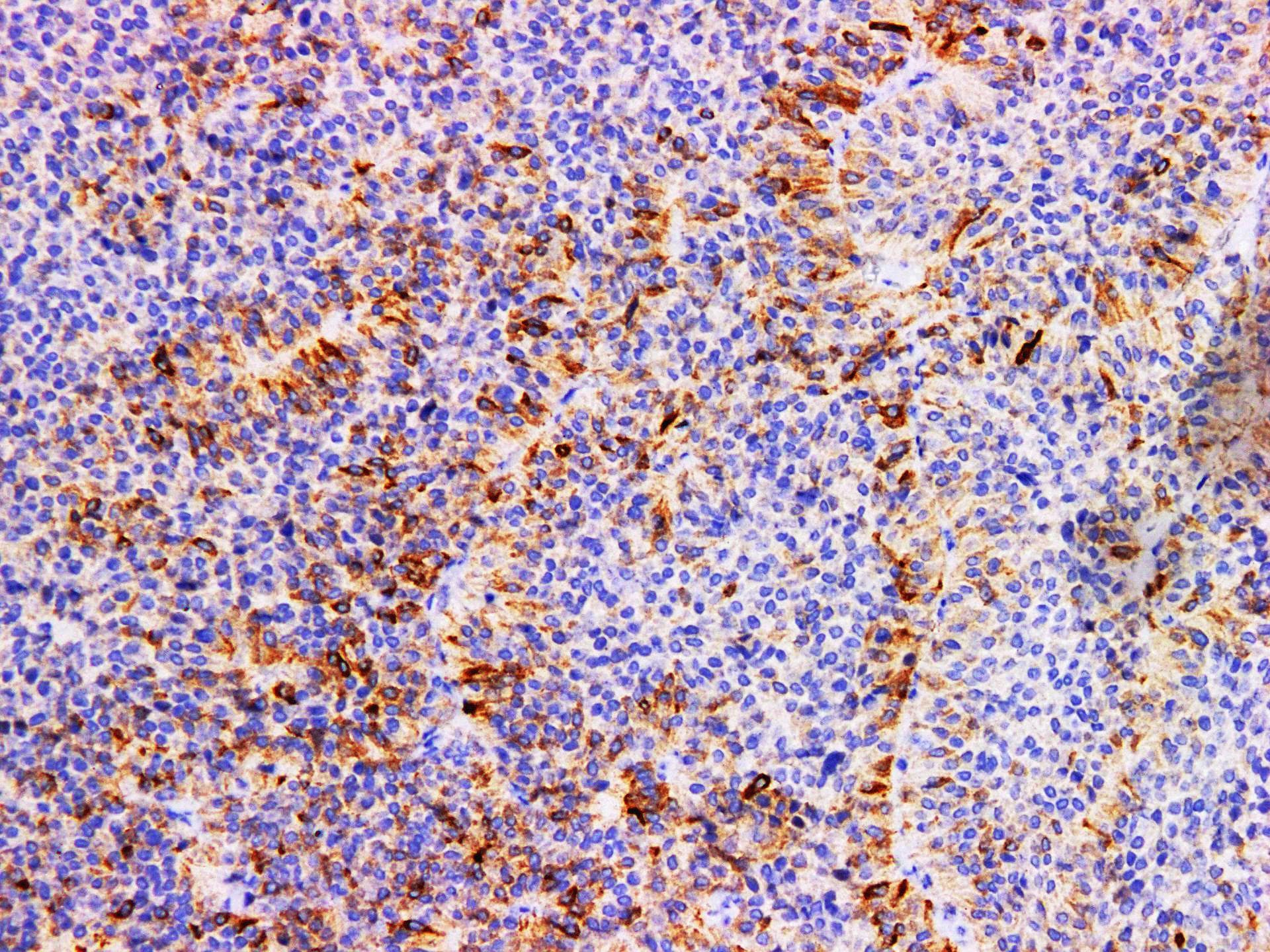 Monoclonal Mouse FSH Antibody (IHC)