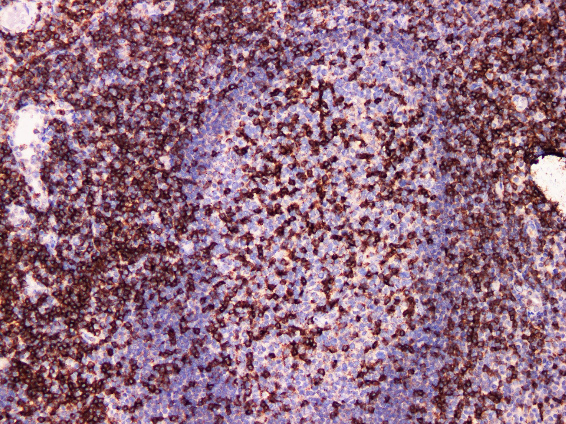 Monoclonal Mouse anti-Human CD2 Antibody (IHC)