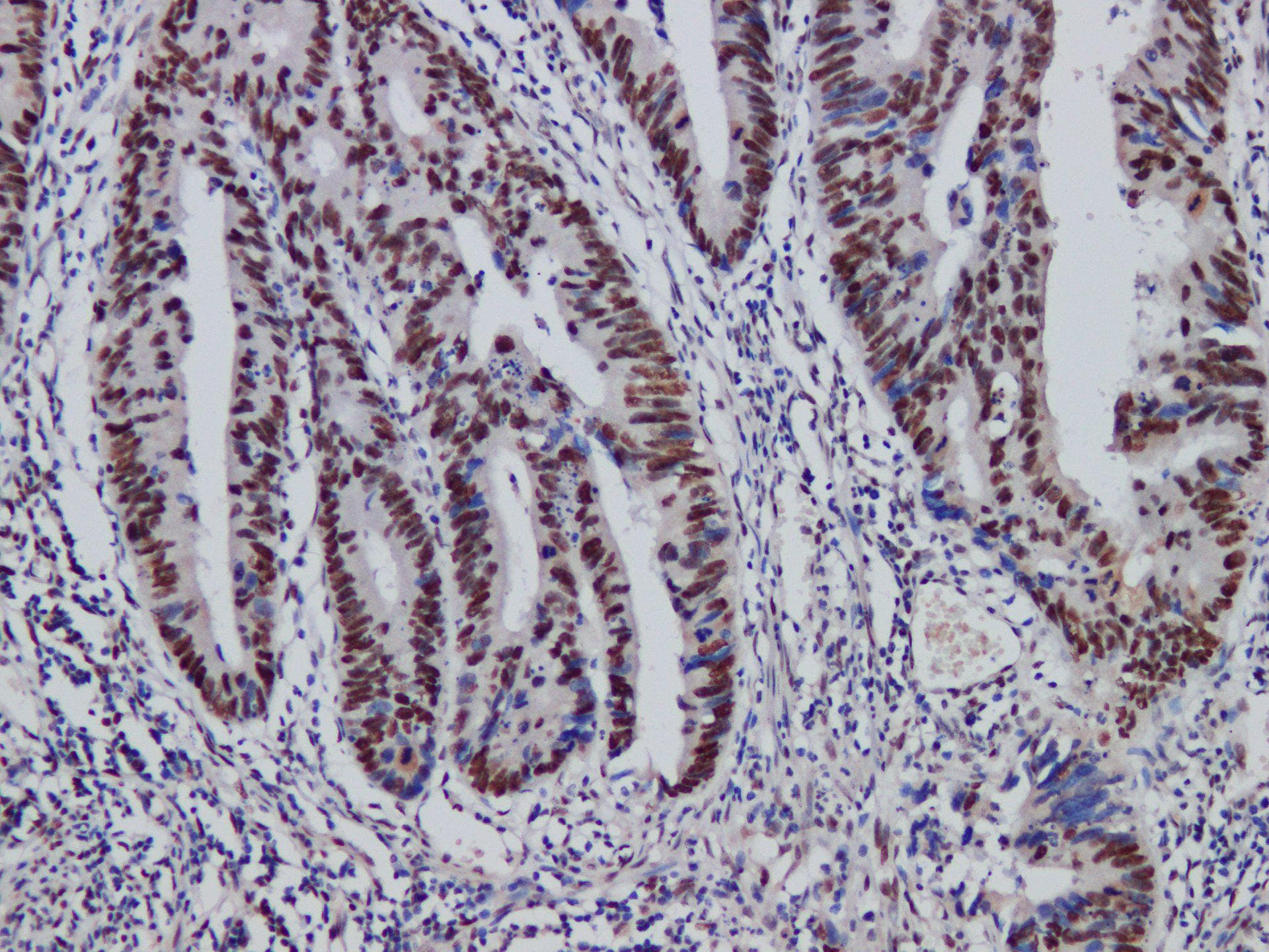Monoclonal Mouse anti-Human MSH2 Antibody (IHC)