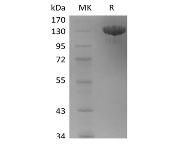 Human TEK / TIE2 Protein (Recombinant Fc, C-terminus)