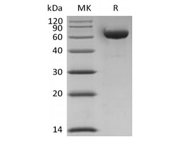 Human LAG3 Protein (Recombinant AVI-6His, C-terminus)