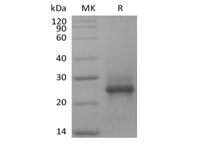 Human KRAS Protein (Recombinant 6His, N-terminus)
