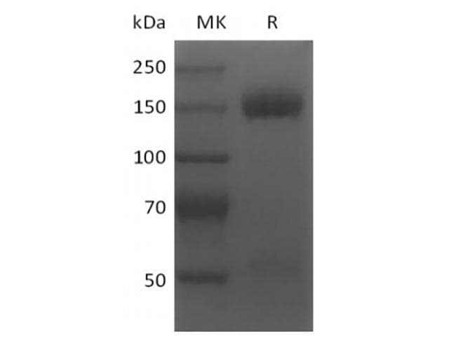 Human TNFRSF17 / BCMA Protein (Recombinant 6His-DDK (Flag), N-terminus)