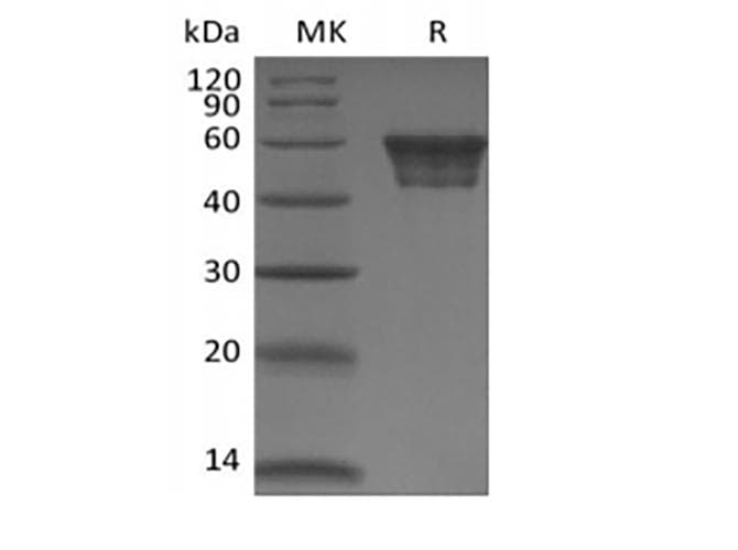 Human CD82 Protein (Recombinant Fc, N-terminus)