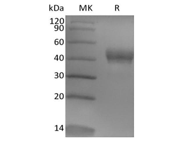 Human TROP2 / TACSTD2 Protein (Recombinant 6His, C-terminus)