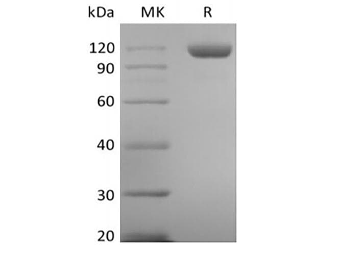 Human TEK / TIE2 Protein (Recombinant 6His, C-terminus)