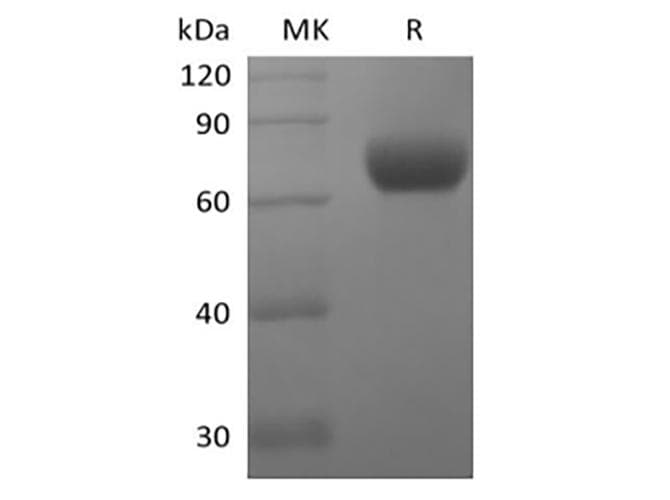 Human CD244 Protein (Recombinant Fc, C-terminus)