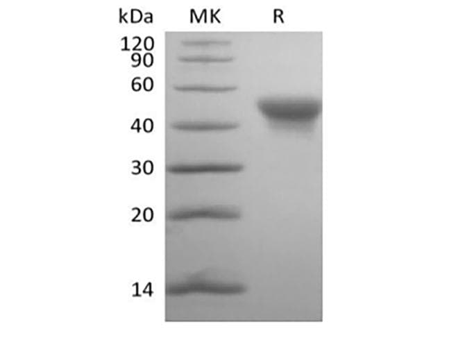 Human CD84 / SLAMF5 Protein (Recombinant AVI-6His, C-terminus)