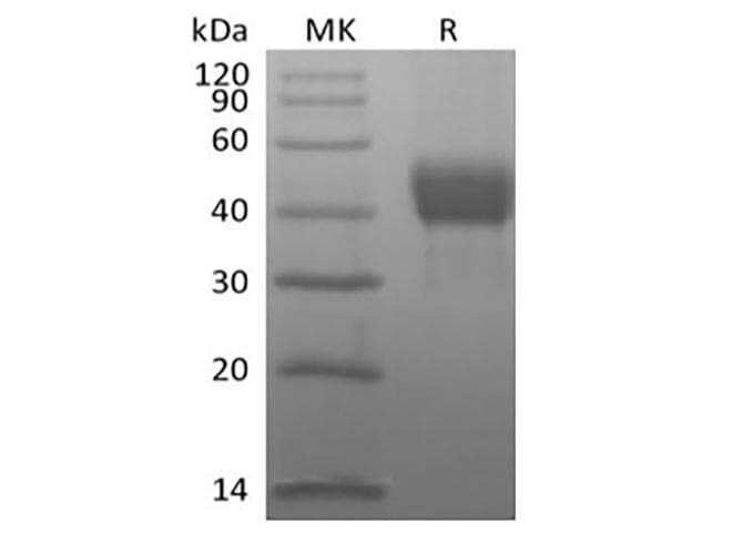 Human TROP2 / TACSTD2 Protein (Recombinant AVI-6His, C-terminus)