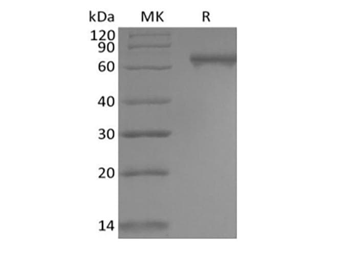 Human NOTCH2 Protein (Recombinant 6His, C-terminus)
