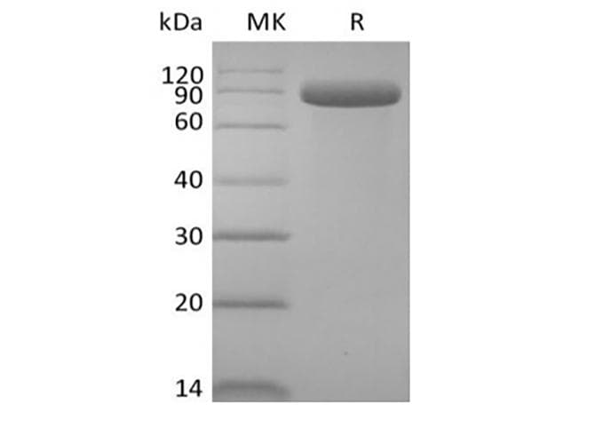 Human DLL4 Protein (Recombinant Fc, C-terminus)