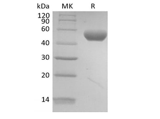 Human PVRL2 / CD112 Protein (Recombinant AVI-6His, C-terminus)