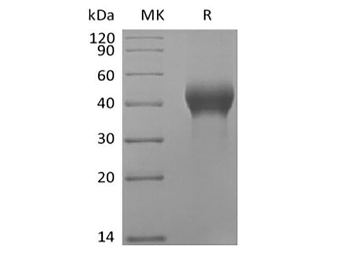 Human DKK1 Protein (Recombinant AVI-6His, C-terminus)