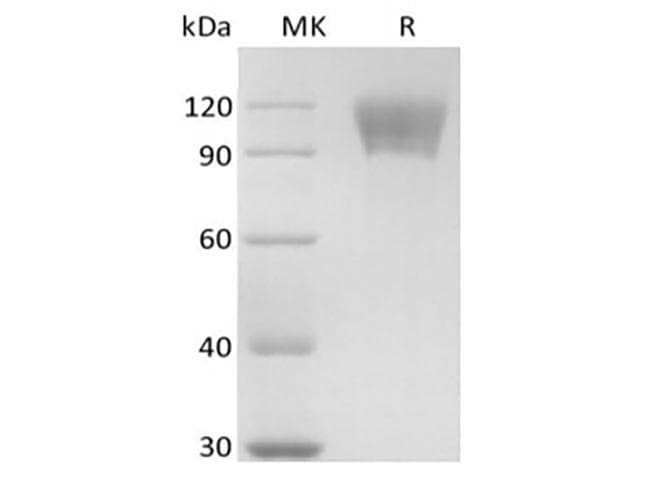 Human CD30 Protein (Recombinant Mouse IgG Fc, C-terminus)