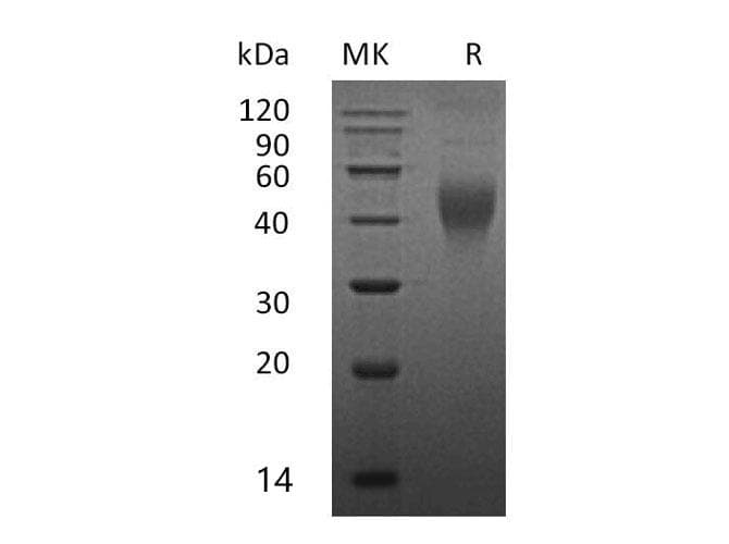 Mouse CSF1 / MCSF Protein (Recombinant)