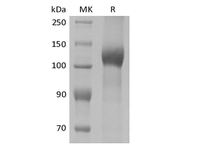 Mouse LEPR / Leptin Receptor Protein (Recombinant 10His, C-terminus)