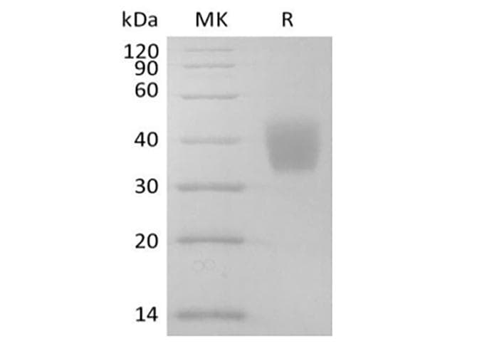 Mouse IL4R / CD124 Protein (Recombinant 6His, C-terminus)