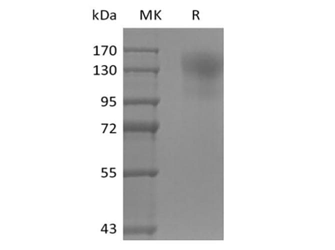 Mouse CD45 / LCA Protein (Recombinant 6His, C-terminus)