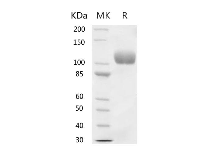 Human ACE2 / ACE-2 Protein (Recombinant 6His, C-terminus)