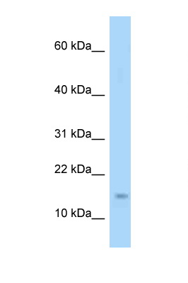 Polyclonal Rabbit anti-Mouse EIF4EBP1 / 4EBP1 Antibody (aa21-70, WB)