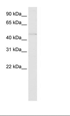 Polyclonal Rabbit anti-Human PAX3 Antibody (FITC, aa400-449, IHC, WB)