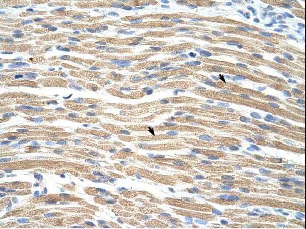 Polyclonal Rabbit anti-Human TEAD1 Antibody (Biotin, C-Terminus, IHC, WB)