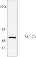 ZAP70 Antibody (aa282-307, clone 1E7.2)